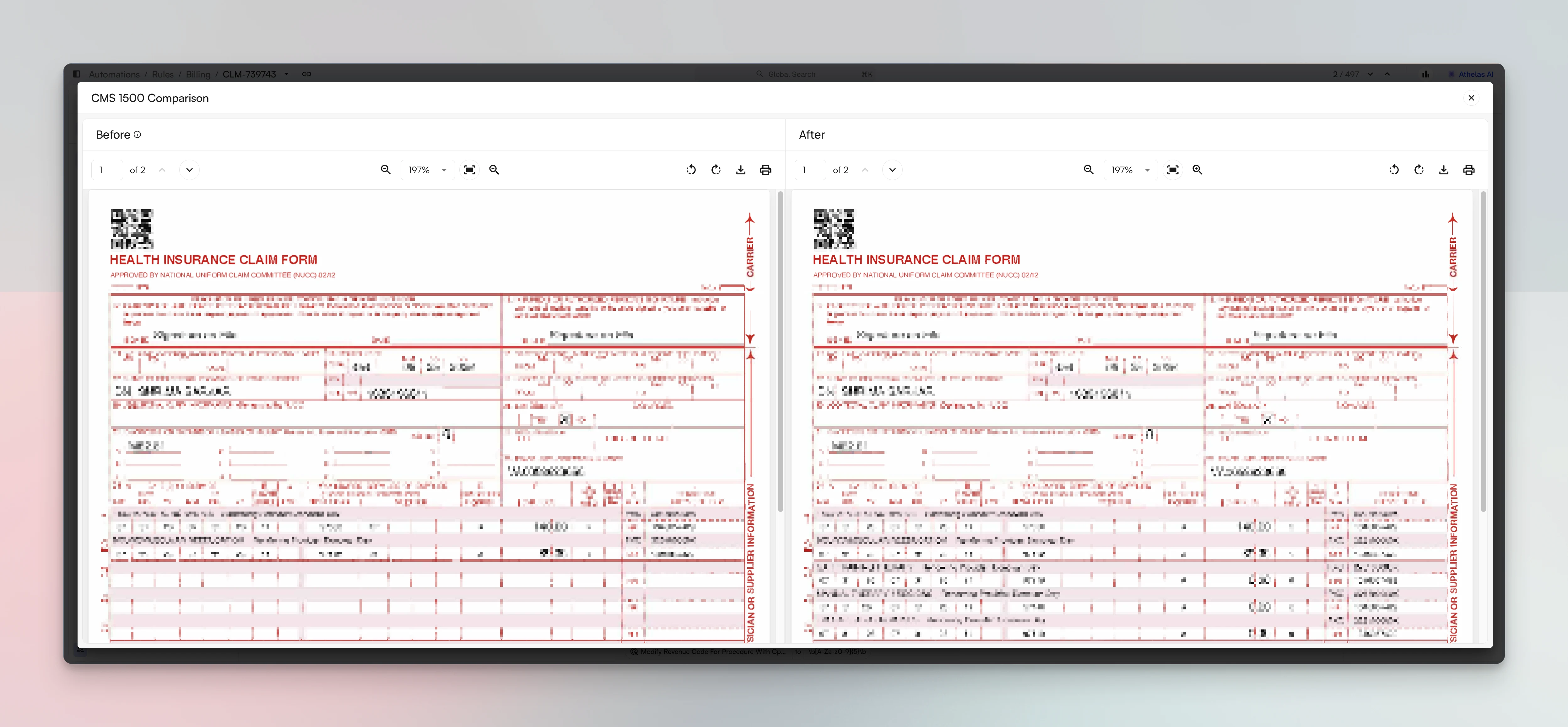 The CMS 1500 Comparison view with Before and After panes side by side