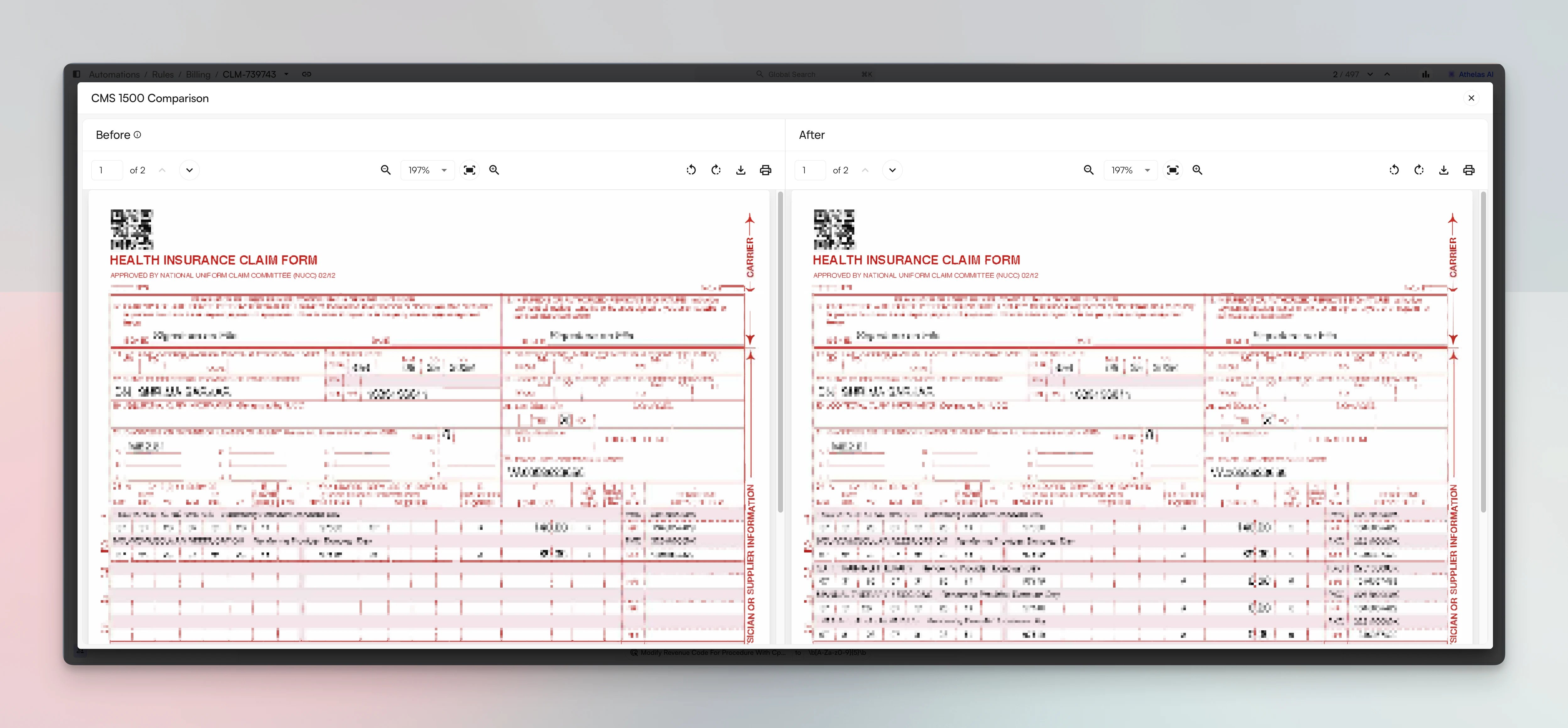 The CMS 1500 Comparison view with Before and After panes side by side