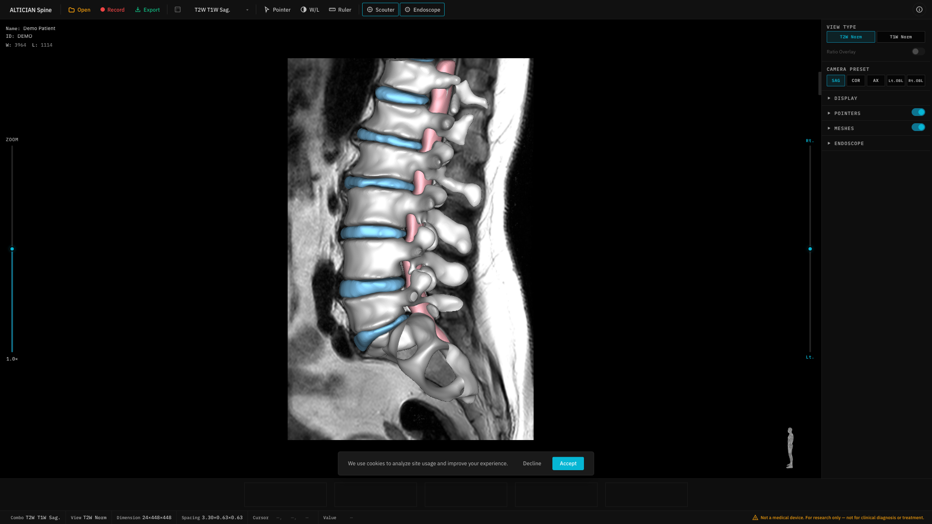 Camera preset buttons