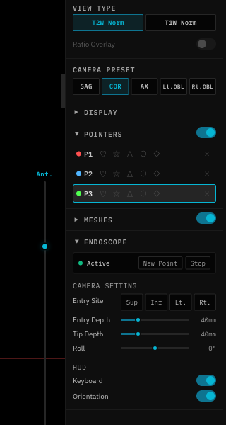 Endoscope camera controls