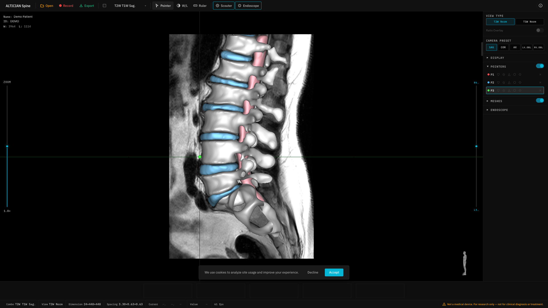 Transparent mesh view