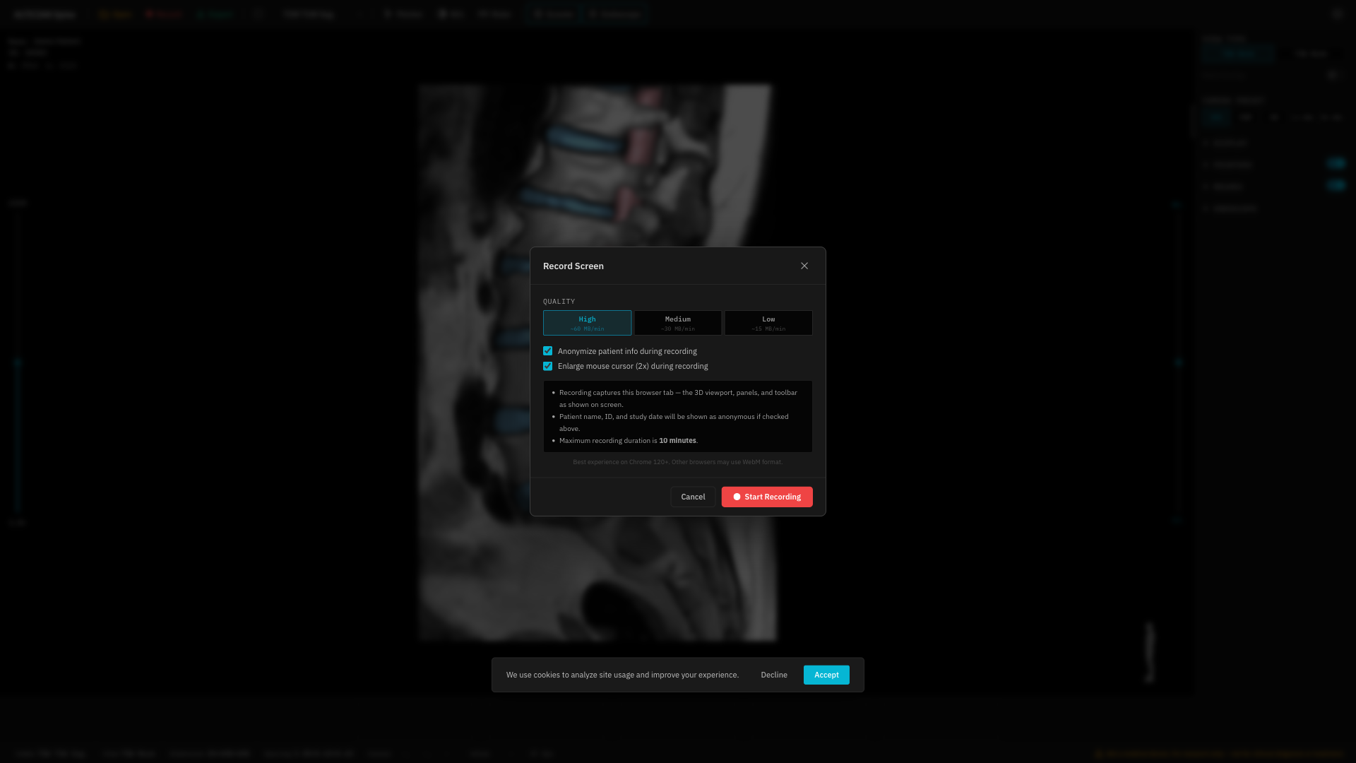 Recording settings modal