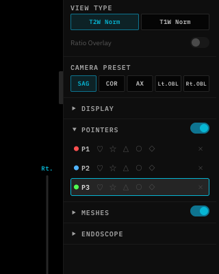 Segmentation in progress