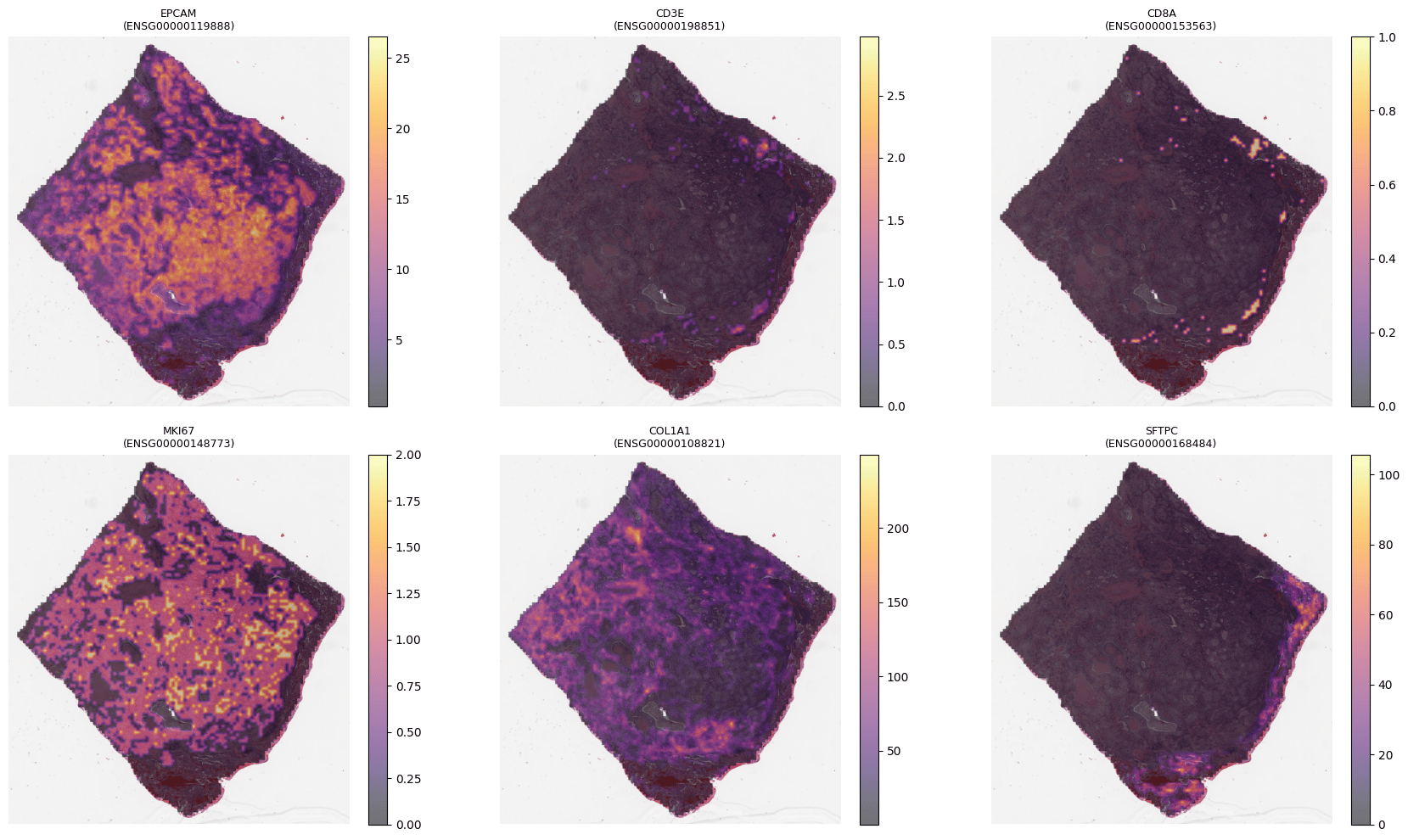 Spatial gene-expression panel overlaid on a slide thumbnail