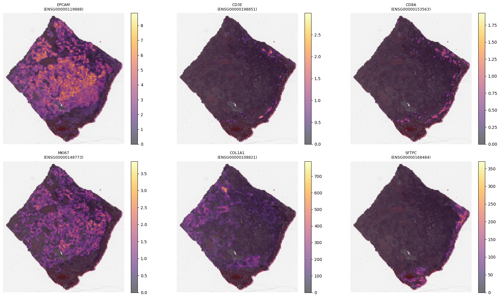 Six-gene spatial expression panel, image only