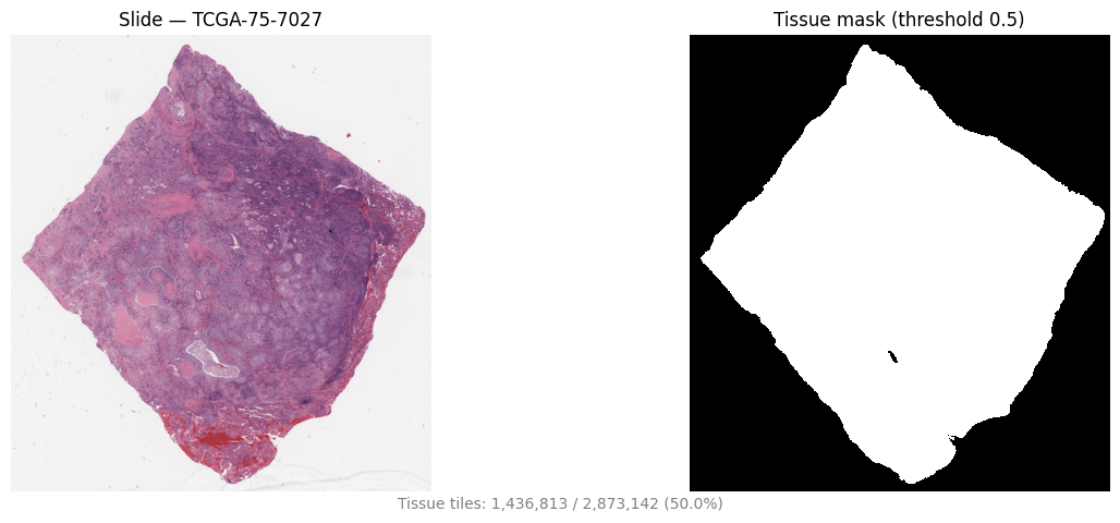 Slide thumbnail alongside its binary tissue mask