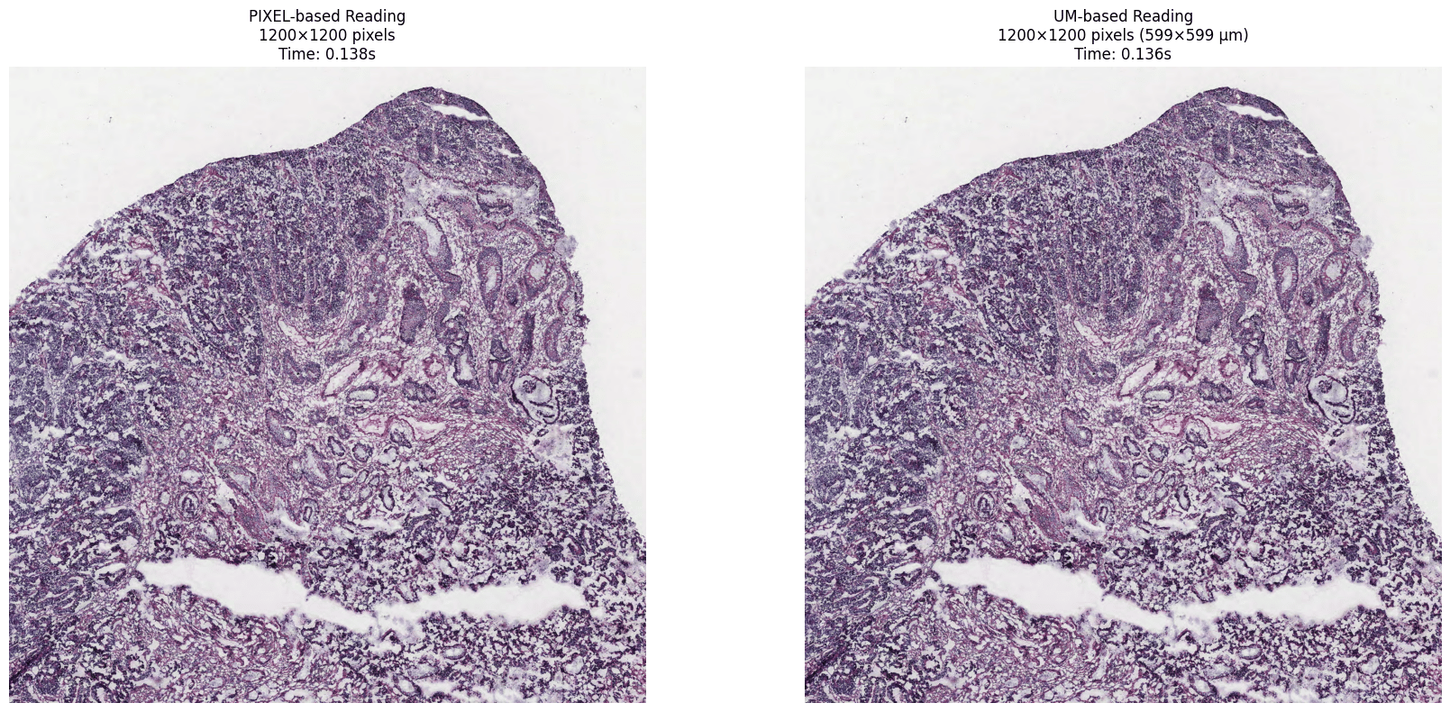 Region read in pixels versus micrometers, side by side