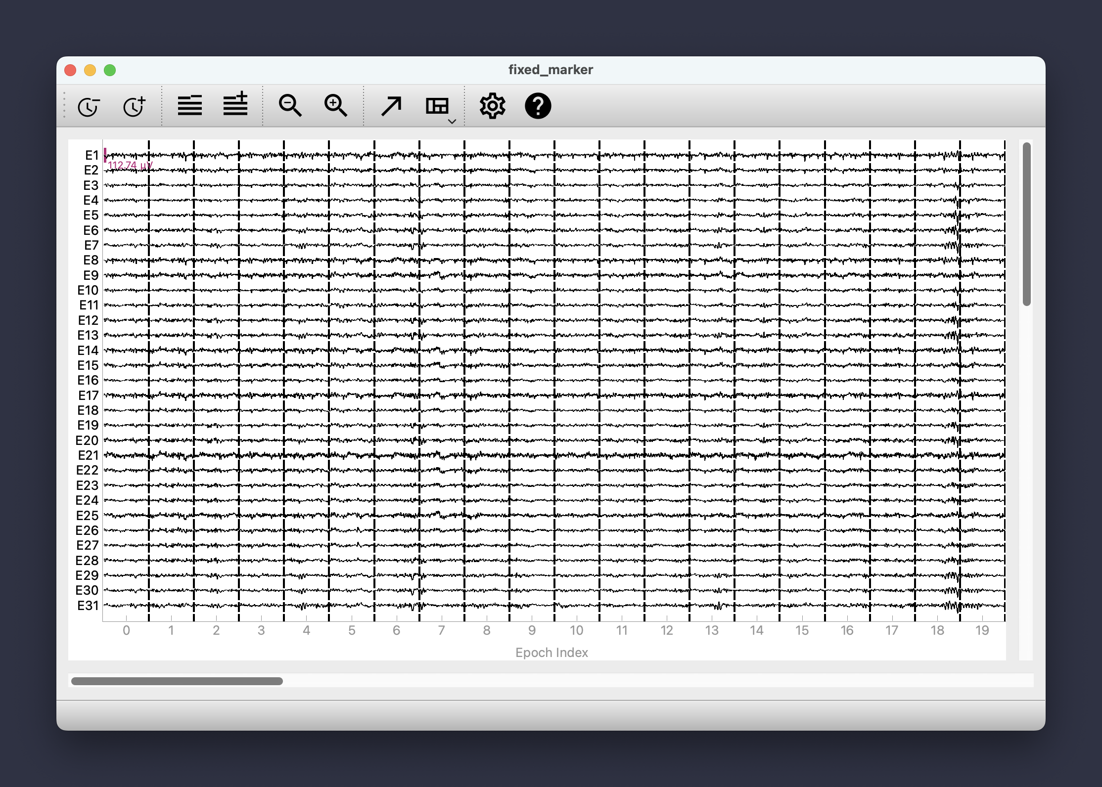 AutocleanEEG viewer showing an EEG file