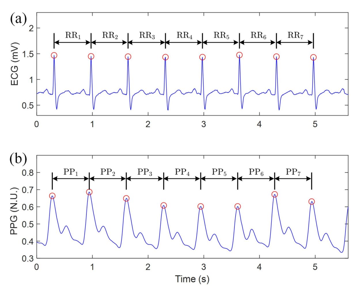 HR/HRV estimation - Edge Impulse Documentation