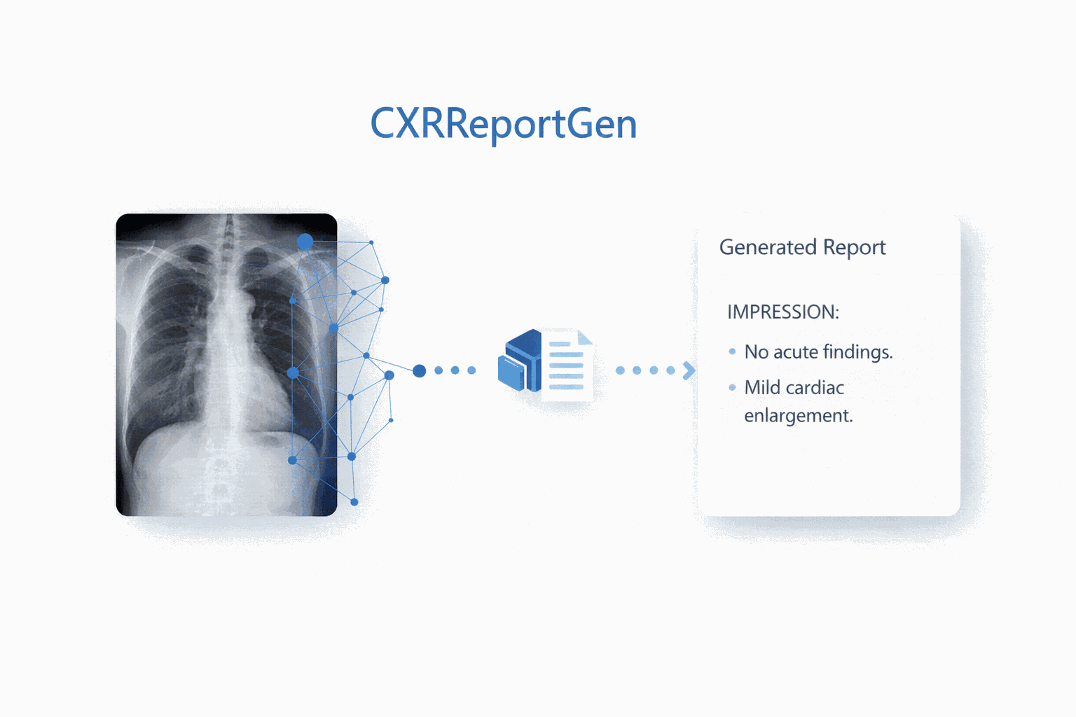 Animated diagram that shows generations of findings from a chest x-ray.