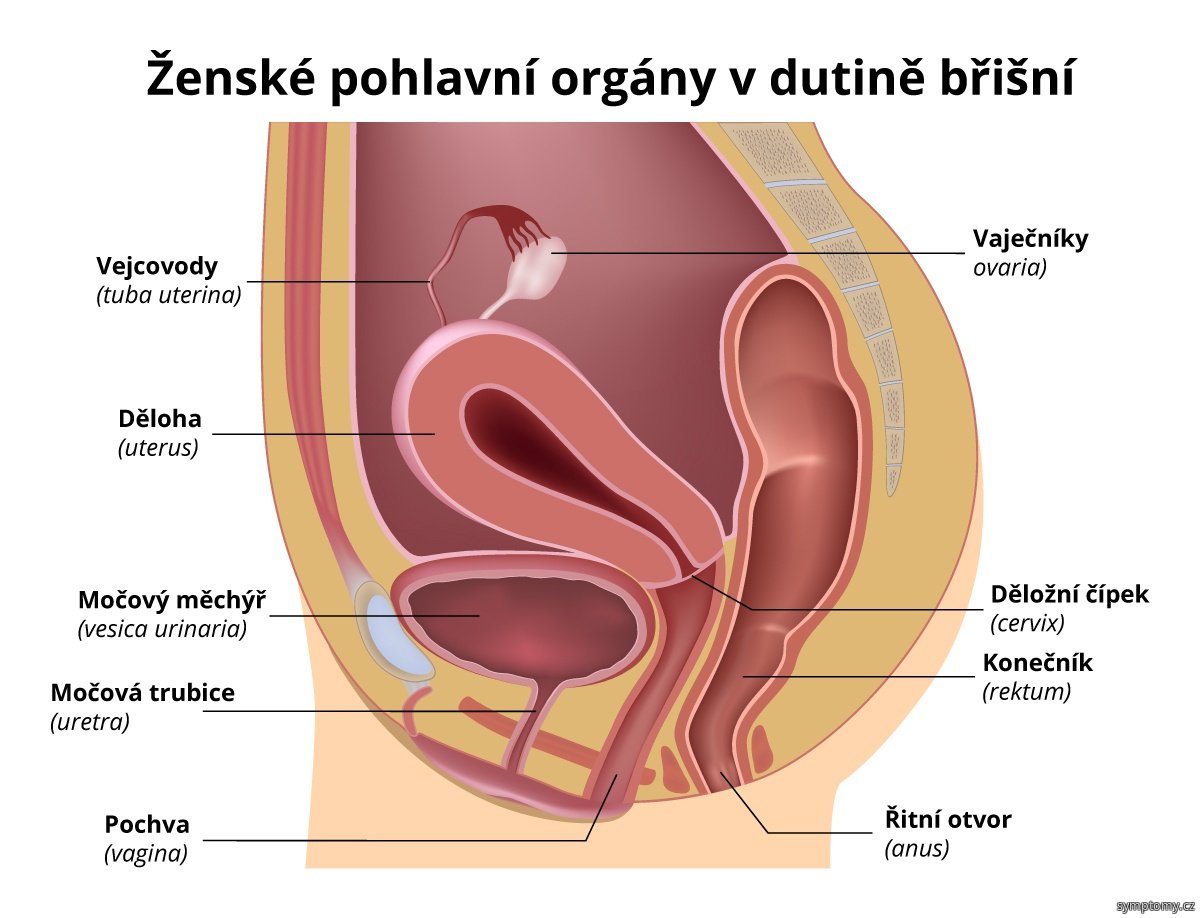 Diagram 3