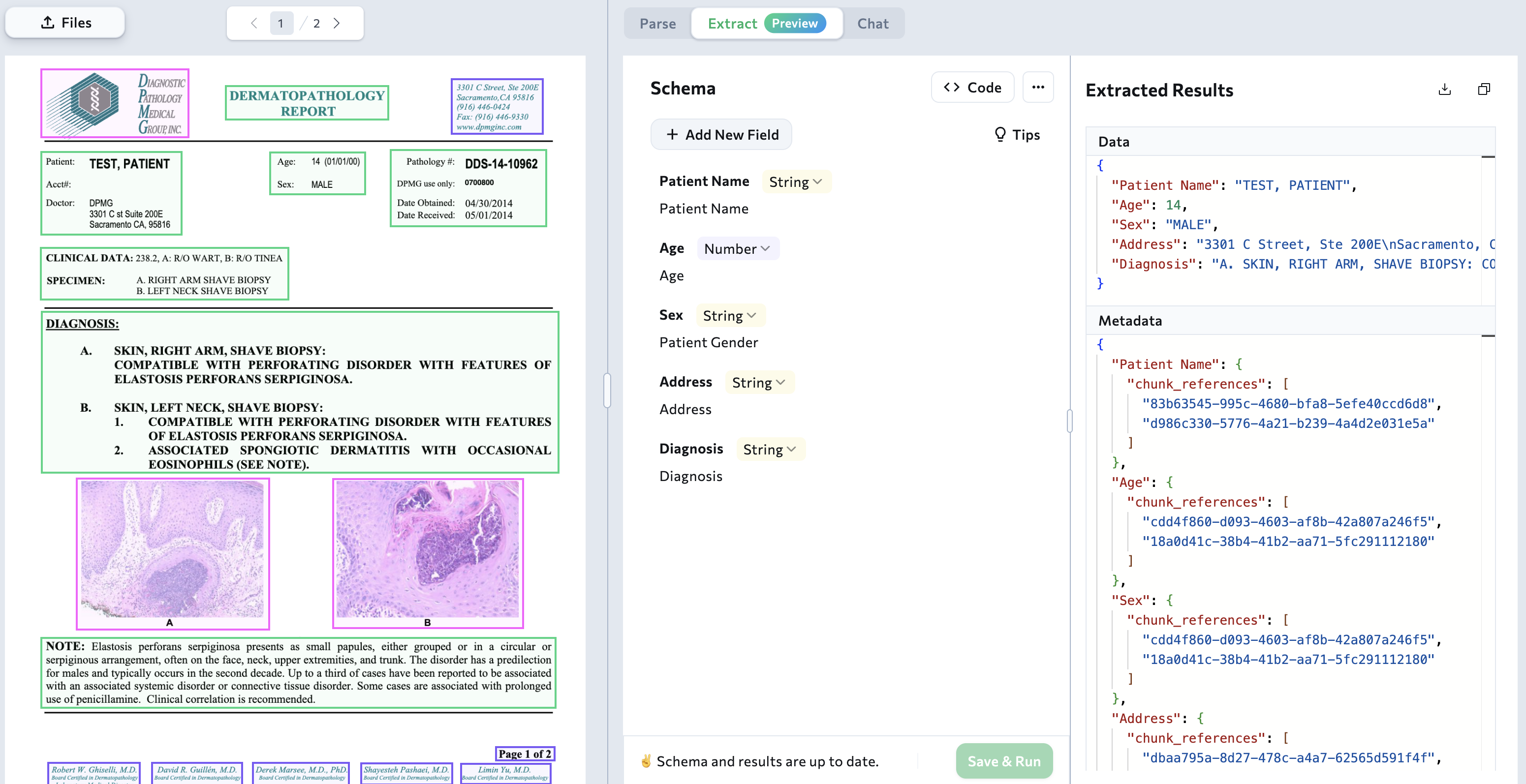 Build a Schema with the Wizard