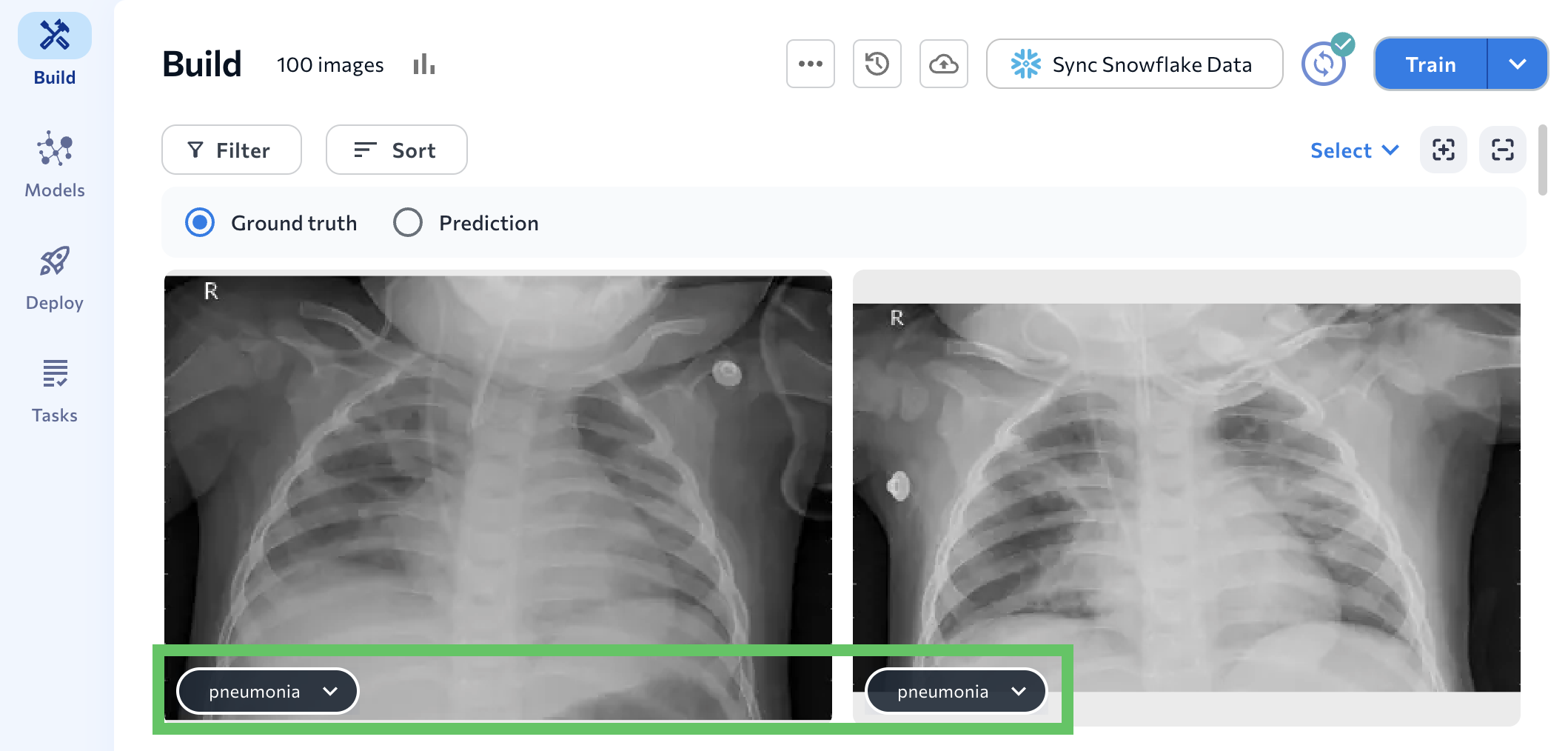 SyncSF_classify_pneumonia_2