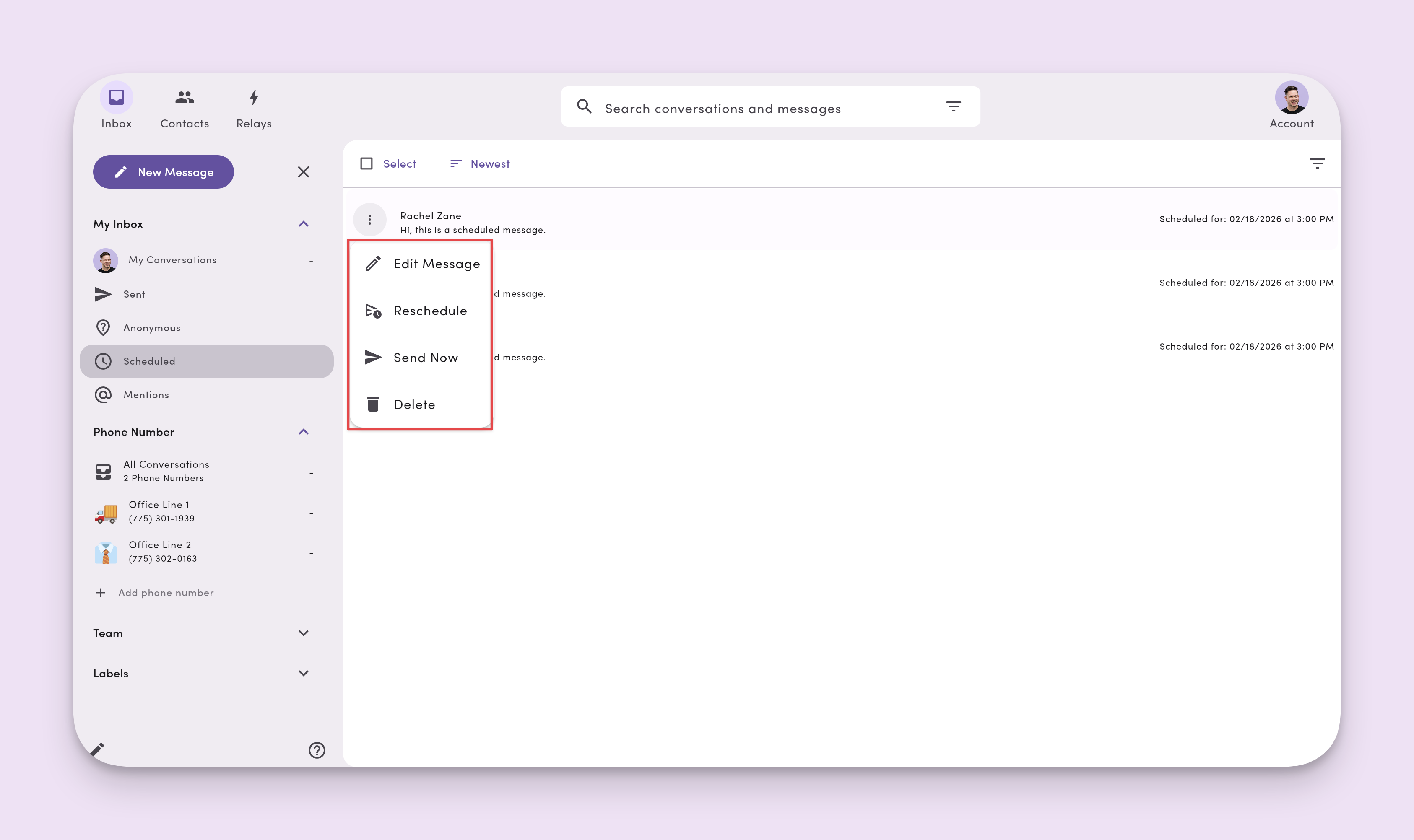 Scheduled Mesages Actions