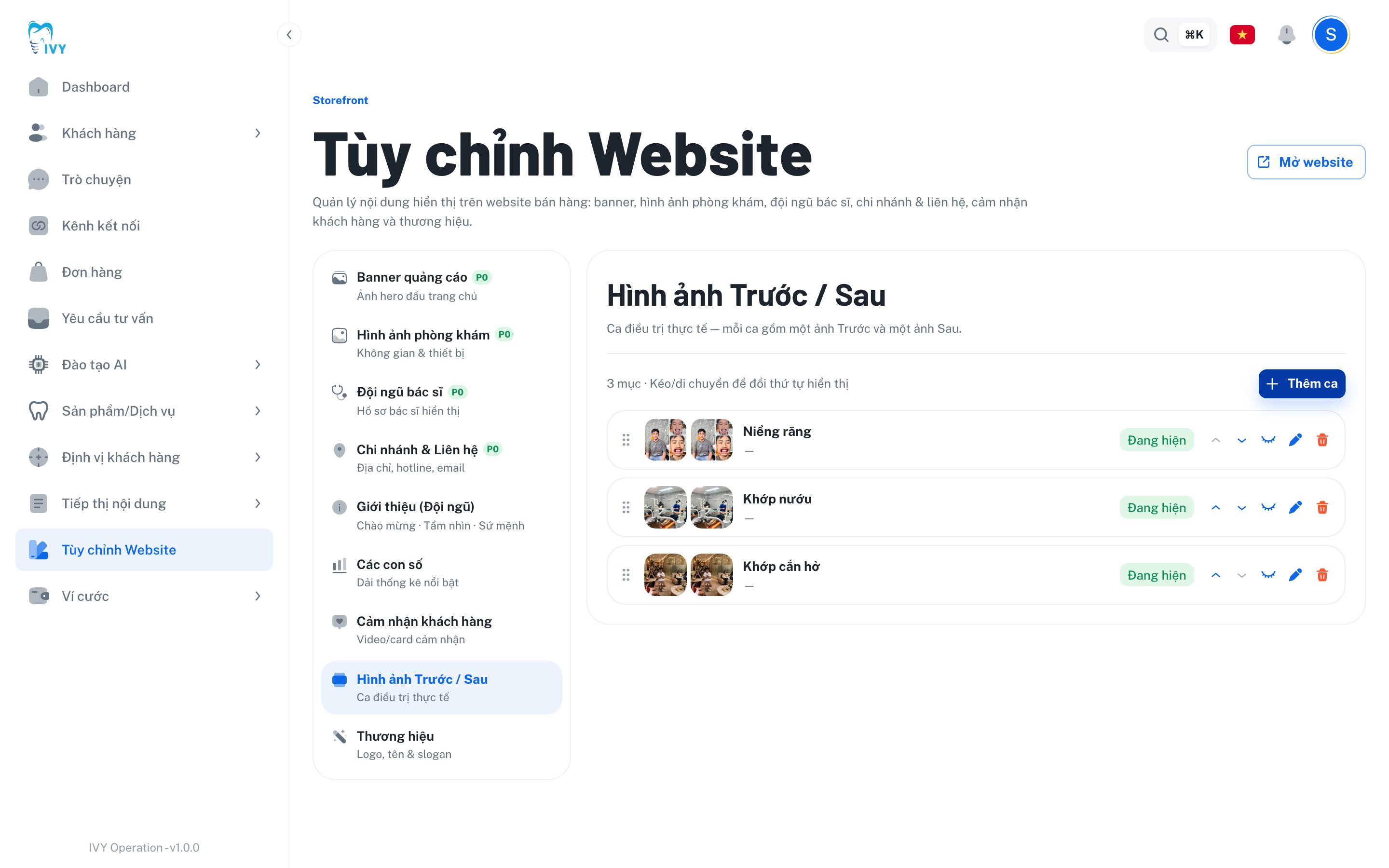Phần Hình ảnh Trước / Sau