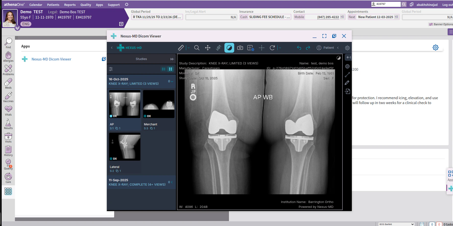 Athena One Viewer Study Loaded Pn