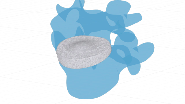 Implant