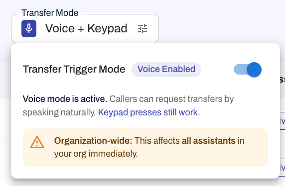 Transfer Trigger Mode toggle showing Voice Enabled with Voice + Keypad