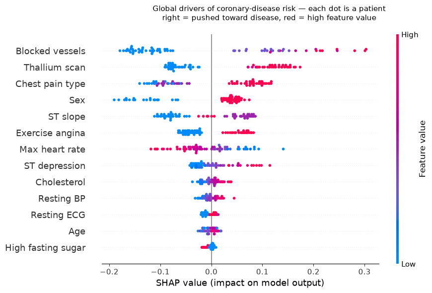 SHAP beeswarm plot of global feature importance for coronary-disease risk