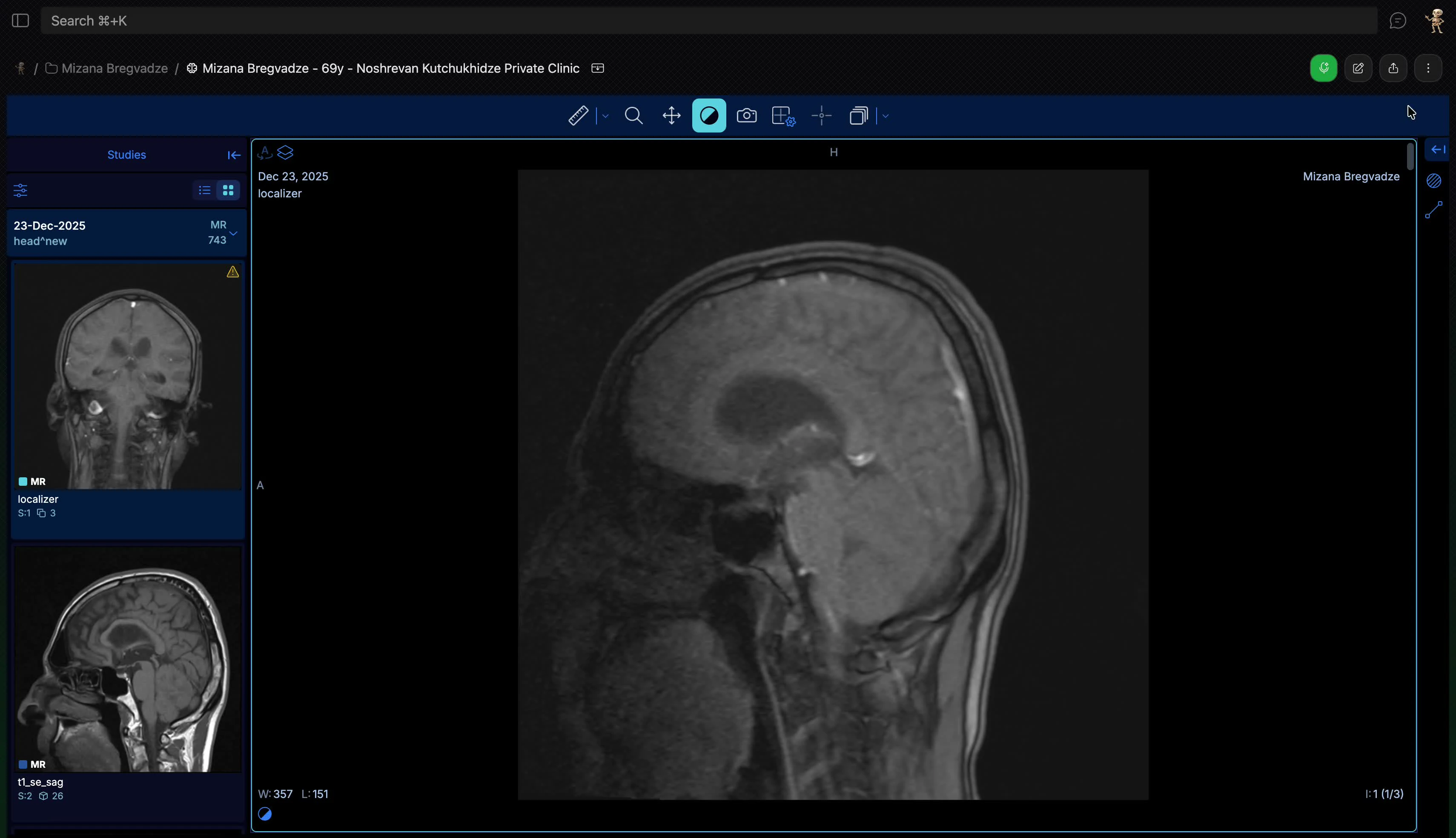 Share ღილაკი DICOM Viewer-ში