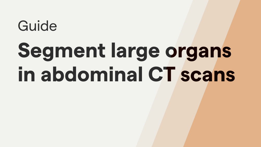 segmentation