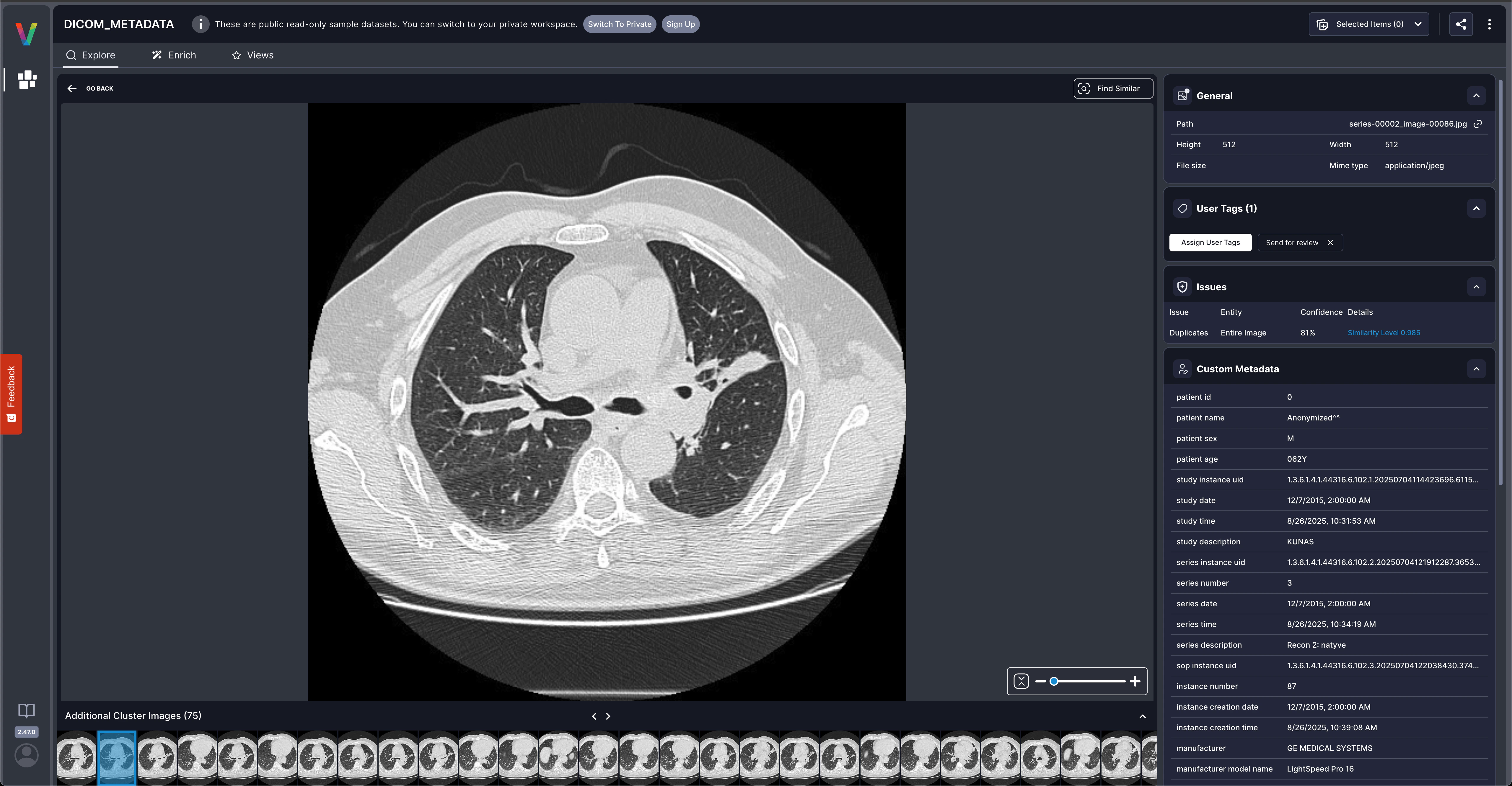 DICOM custom metadata displayed in Visual Layer showing patient age, manufacturer, modality, and other medical imaging fields