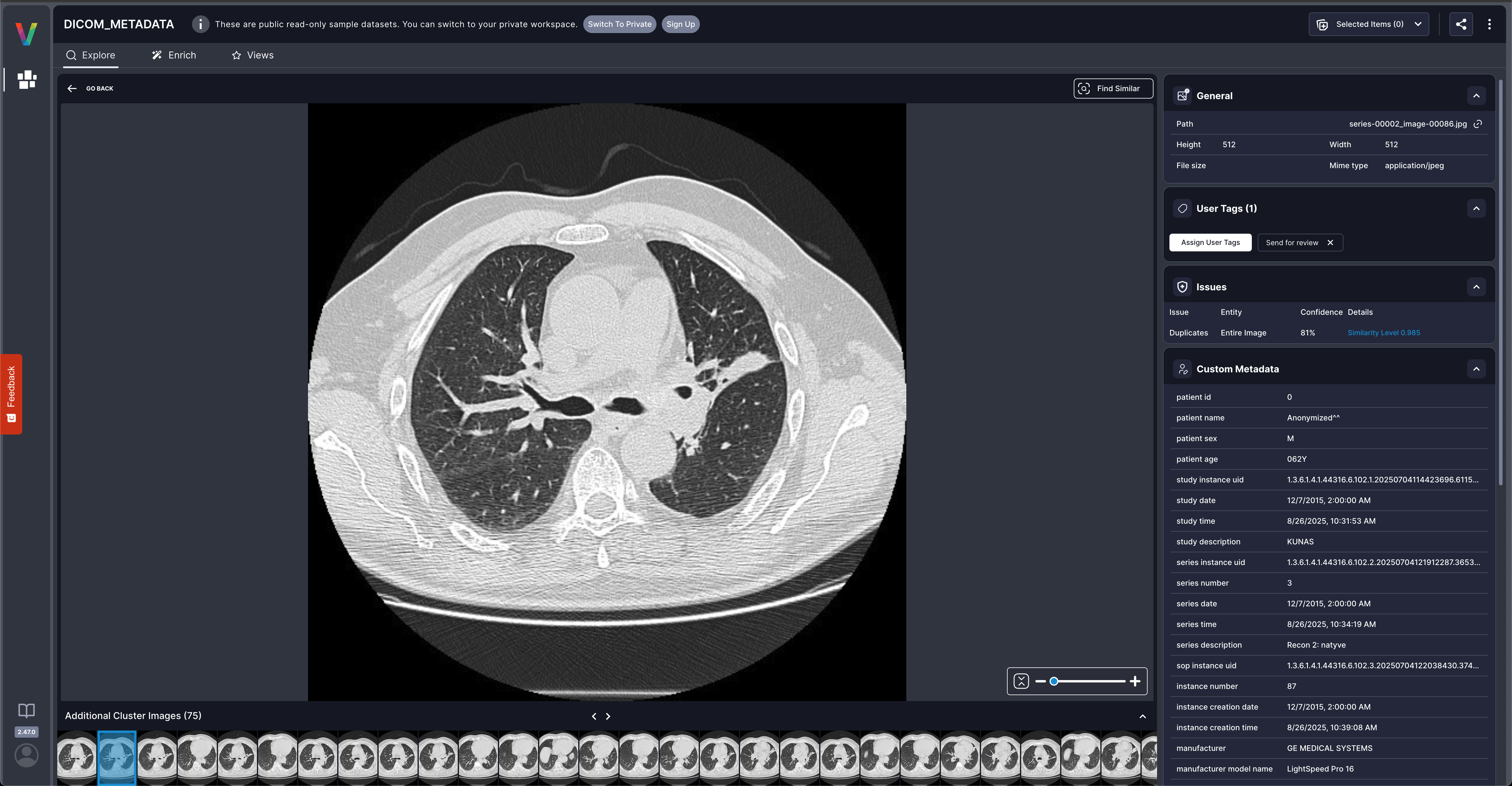 DICOM custom metadata displayed in Visual Layer showing patient age, manufacturer, modality, and other medical imaging fields