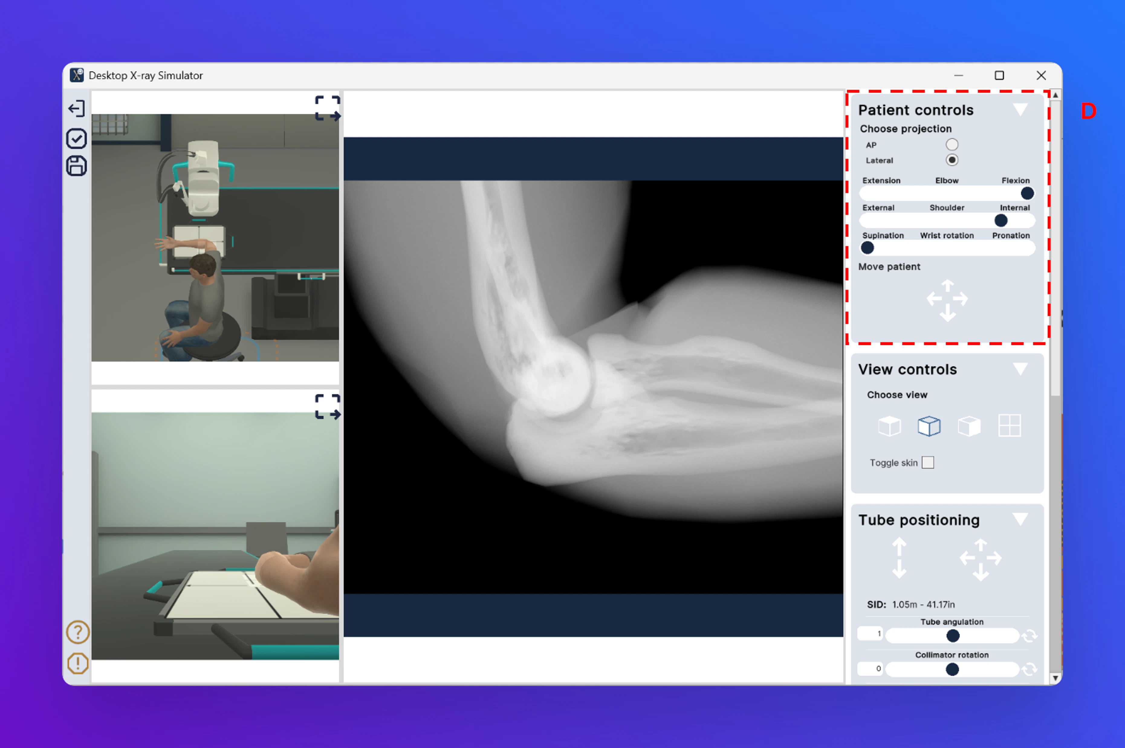 Deskotpxraysimpatientcontrols