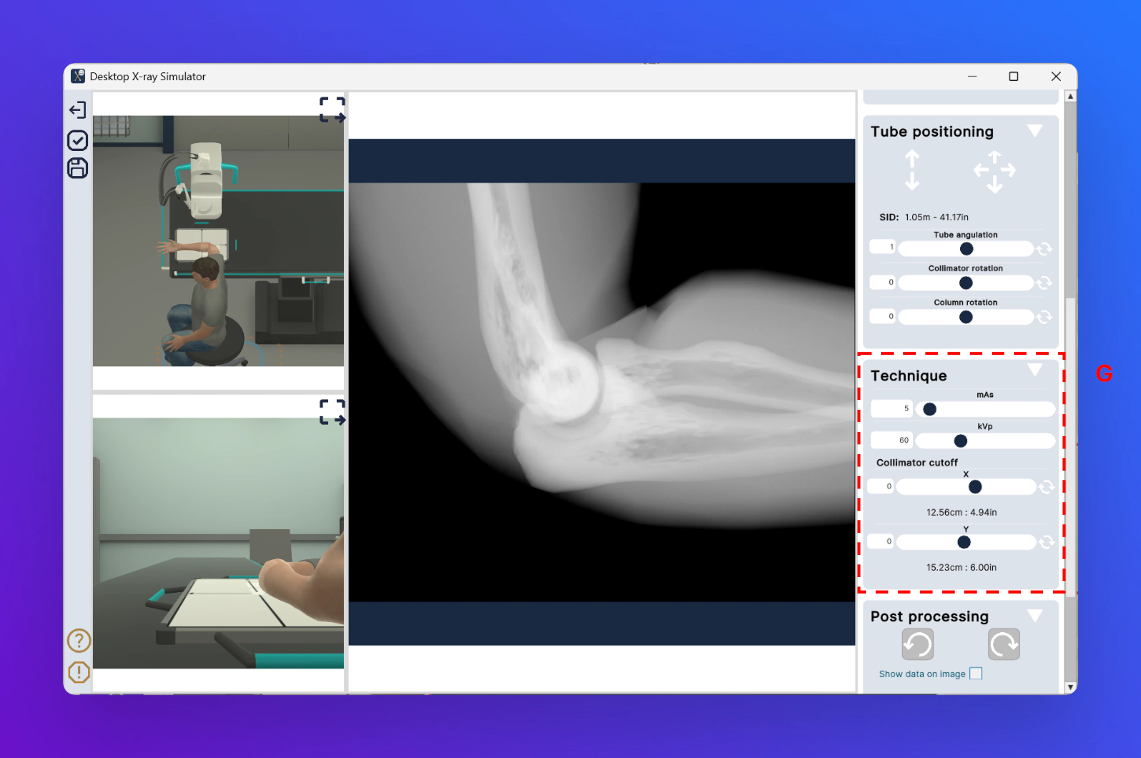 Desktopxraysim Technicque