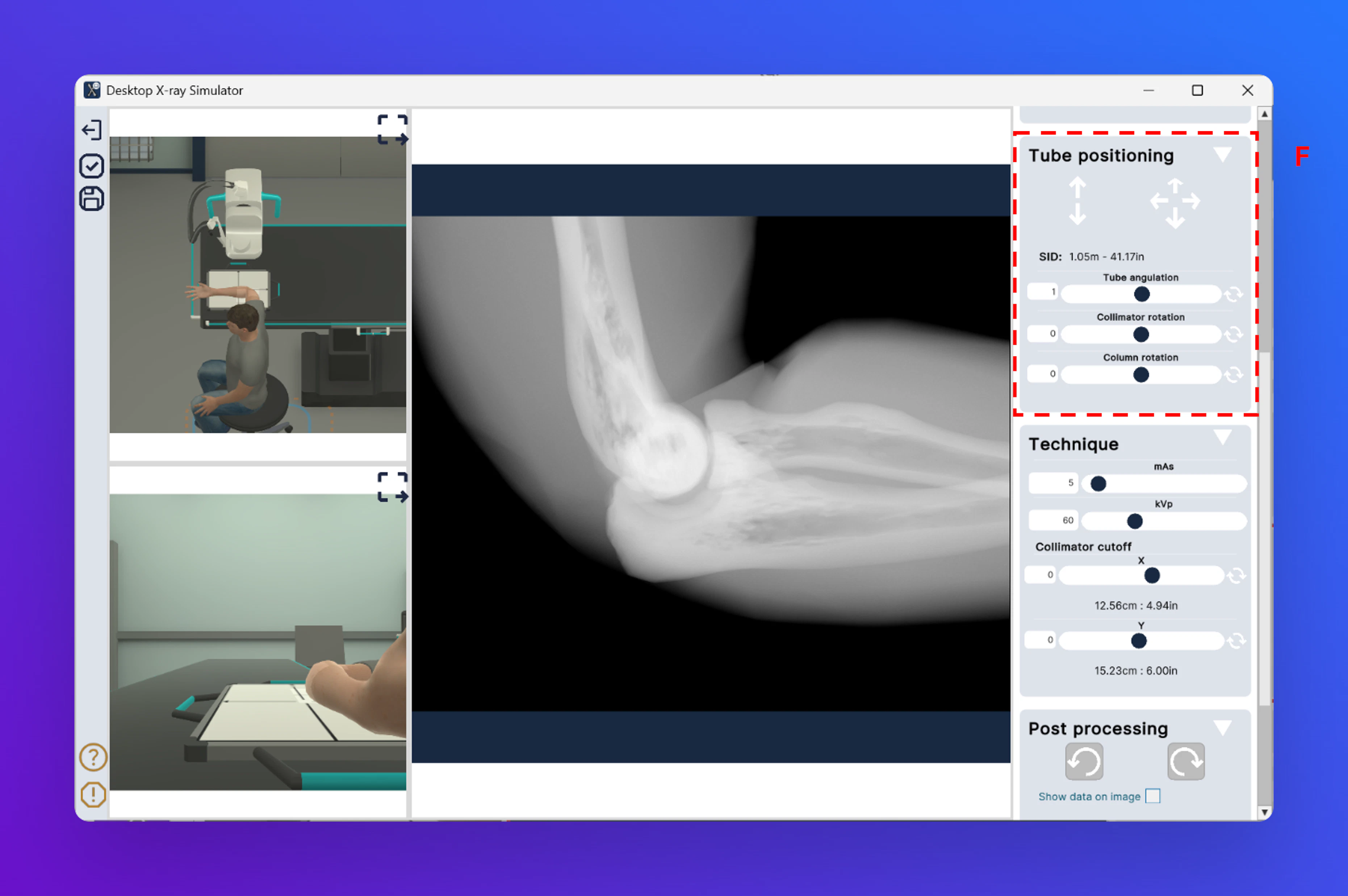 Desktopxraysimtubepositioning