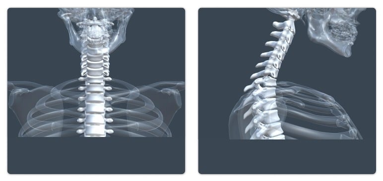 C-spine bone model examples