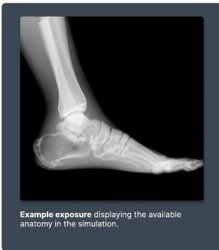 Example exposure from the Foot simulation
