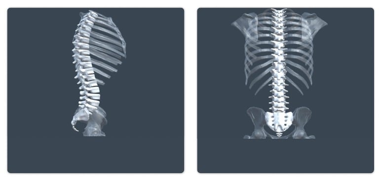 L-spine bone model examples