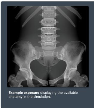 Example exposure from the L-spine simulation