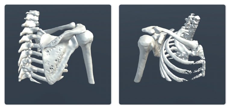Shoulder bone model examples