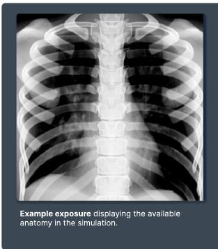 Example exposure from the T-spine simulation