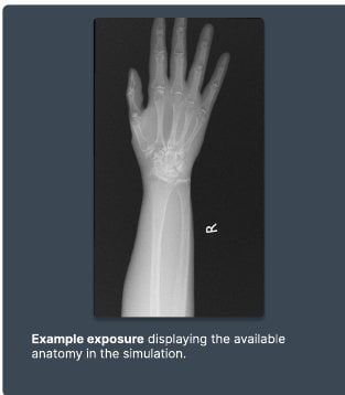 Example exposure from the Wrist simulation
