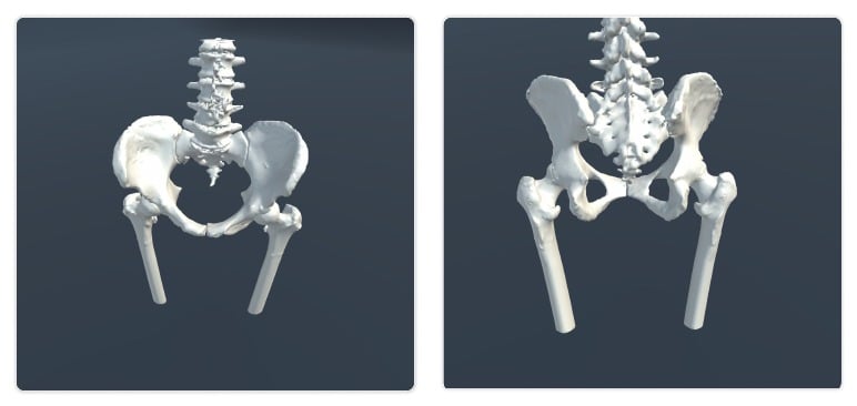 Hip and Pelvic bone model examples