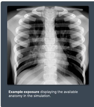 Example exposure from the simulator
