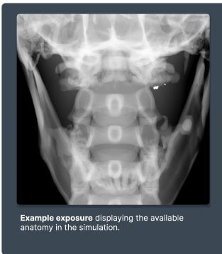 Example exposure from the simulator
