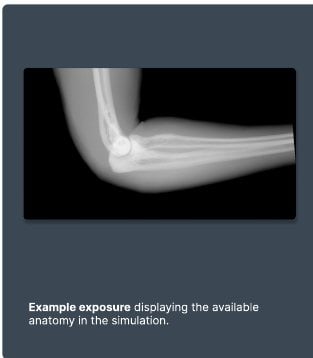Example exposure from the simulator