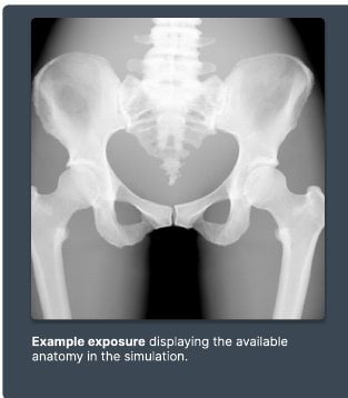 Example exposure from the simulator