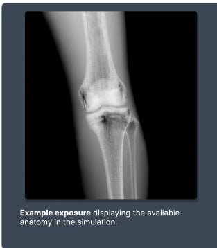 Example exposure from the simulator