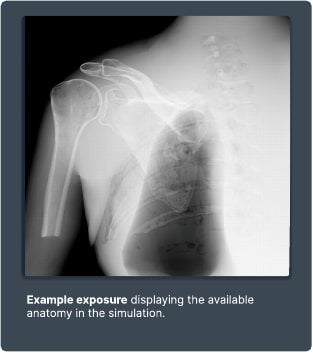 Example exposure from the simulator