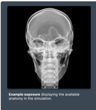 Example exposure from the simulator